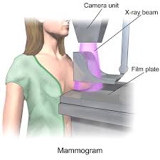 mamografi-ne-zaman-ve-ne-siklikta-yapilmalidi