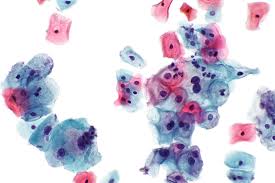 servikal-smear-testi