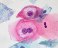 thin-prep-smear-testi-ve-avantajlari