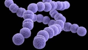 130916171204-erythromycin-resistant-group-a-streptococcus-horizontal-gallery