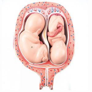 l10-7_01_1200_1200_5th-month-twin-fetuses-normal-position