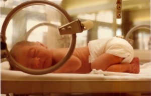neonatal_jacoplane